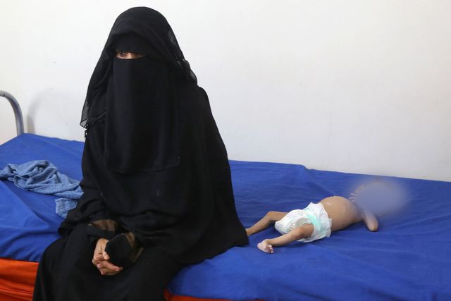 La Jornada Millones de niños en Yemen en riesgo de desnutrición