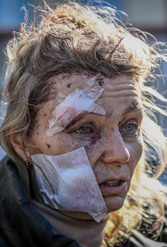  Una mujer herida espera frente a un hospital después de un bombardeo en la ciudad de Chuguiv, en el este de Ucrania. Se informó que las fuerzas armadas rusas utilizaron aviones, cohetes y helicópteros. Foto Afp
