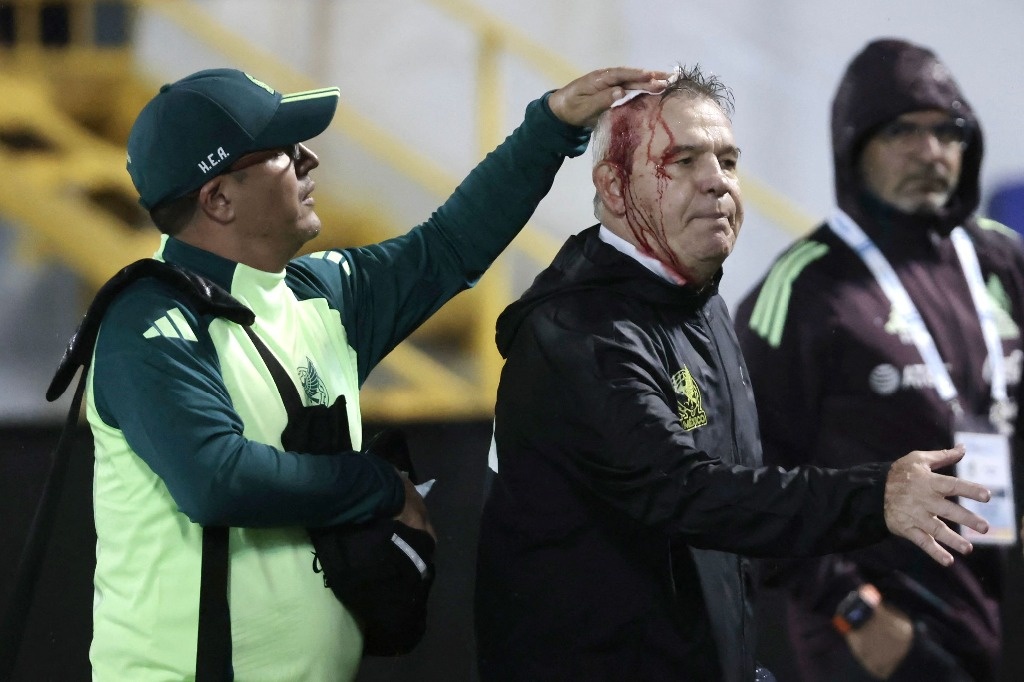 I don’t know the extent of the pain of our fans: ‘Vasco’ Aguirre